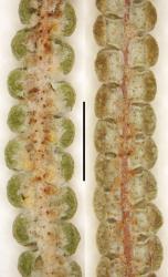 Gleichenia dicarpa. Abaxial surface of the ultimate leaflet (with α costa): group C (WELT P026817) at left; group D (WELT P021155) at right.  Scale bar = 2 mm. 
 Image: L.R. Perrie © Te Papa 2014 CC BY-NC 3.0 NZ